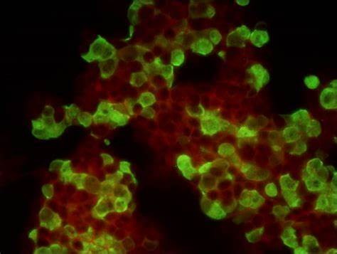 疾控中心病毒實(shí)驗(yàn)室的顯微鏡應(yīng)用